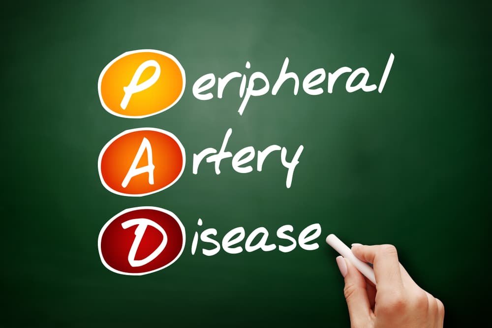 Pad,-,Peripheral,Artery,Disease,Acronym,,Health,Concept,Background
