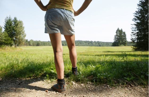 Woman with painful varicose veins on legs resting on a walk through nature.