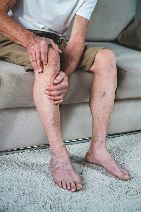 Knee pain in an elderly man